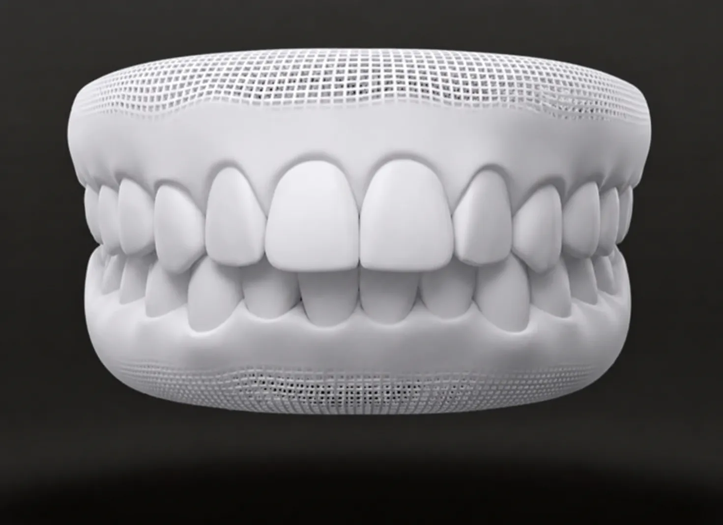 3-d Modell Überbiss
