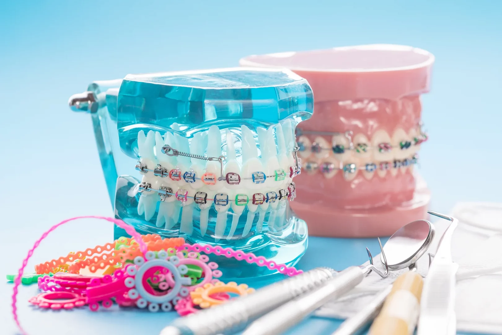 3D-Zahnmodell mit klassischen Brackets und elastischen Ligaturen einer festen Zahnspange.