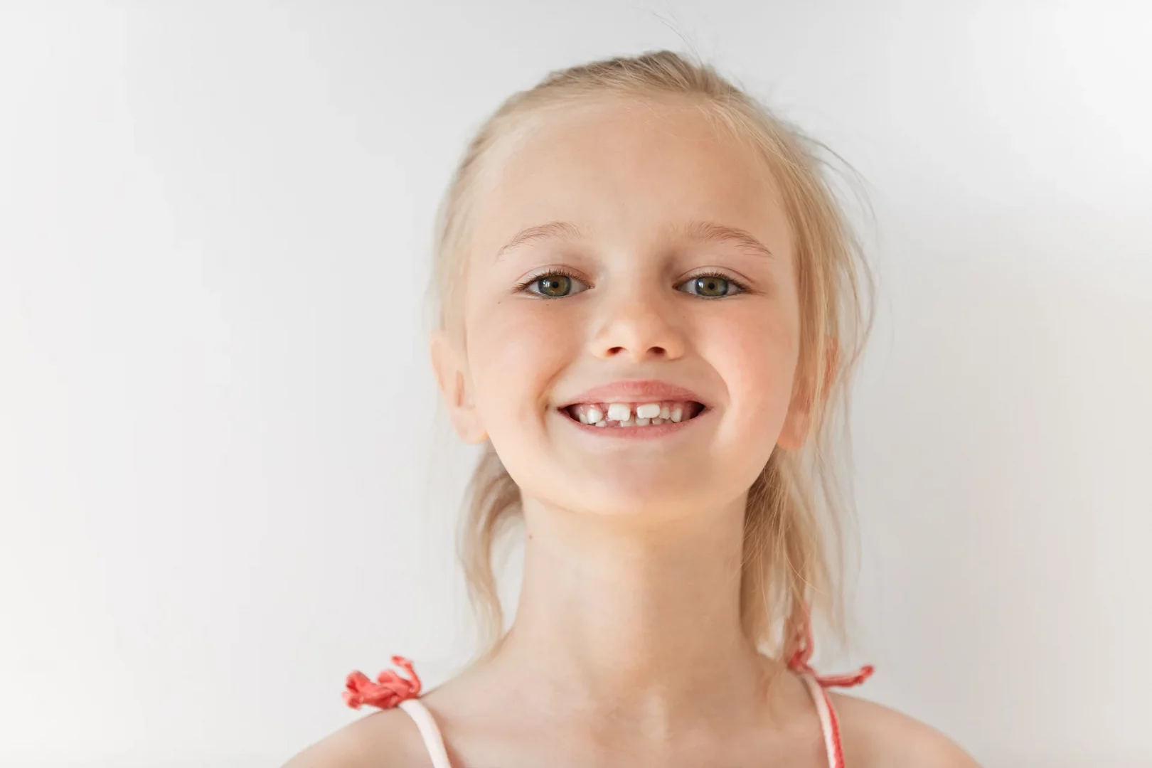 Mädchen im Wechselgebiss mit sichtbaren Zahn- und Kieferfehlstellungen bei Kindern.